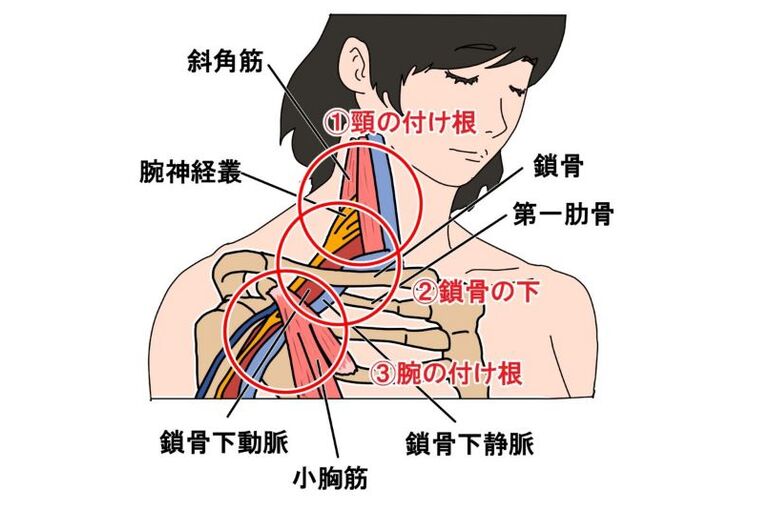 胸郭出口