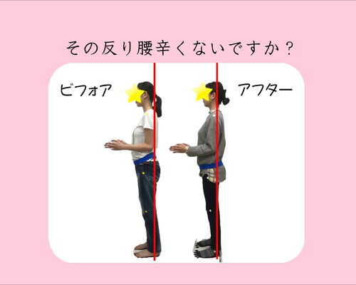 反り腰横