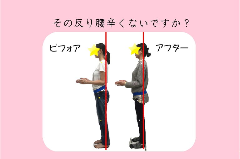 反り腰横