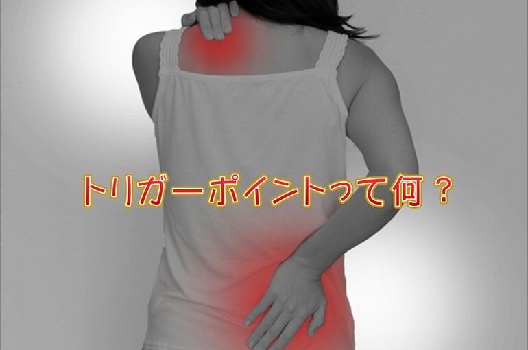 トリガーポイント